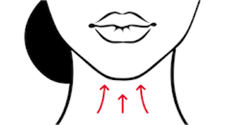 Neck Lift - Turkey Neck Thread Lift Toronto